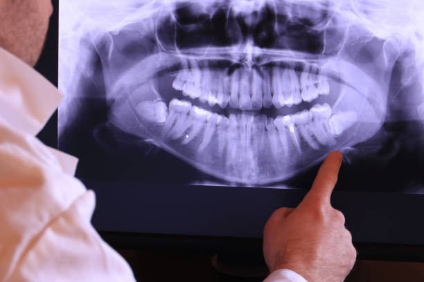 Best Emergency Dental Care for Broken or Chipped Teeth in Emporium, PA